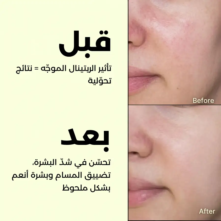 Before After results